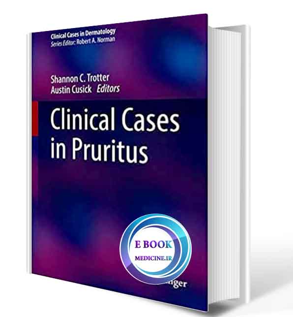 دانلود کتابClinical Cases in Pruritus (Clinical Cases in Dermatology) 2021 (ORIGINAL PDF)